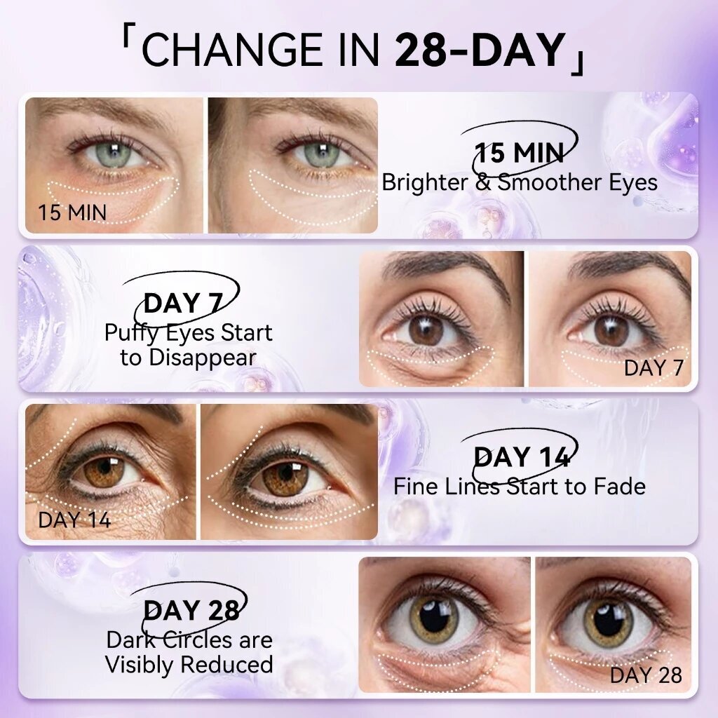 LANBENA Retinol Anti-Wrinkle E - Microneedle Patch Eye 评论和价格