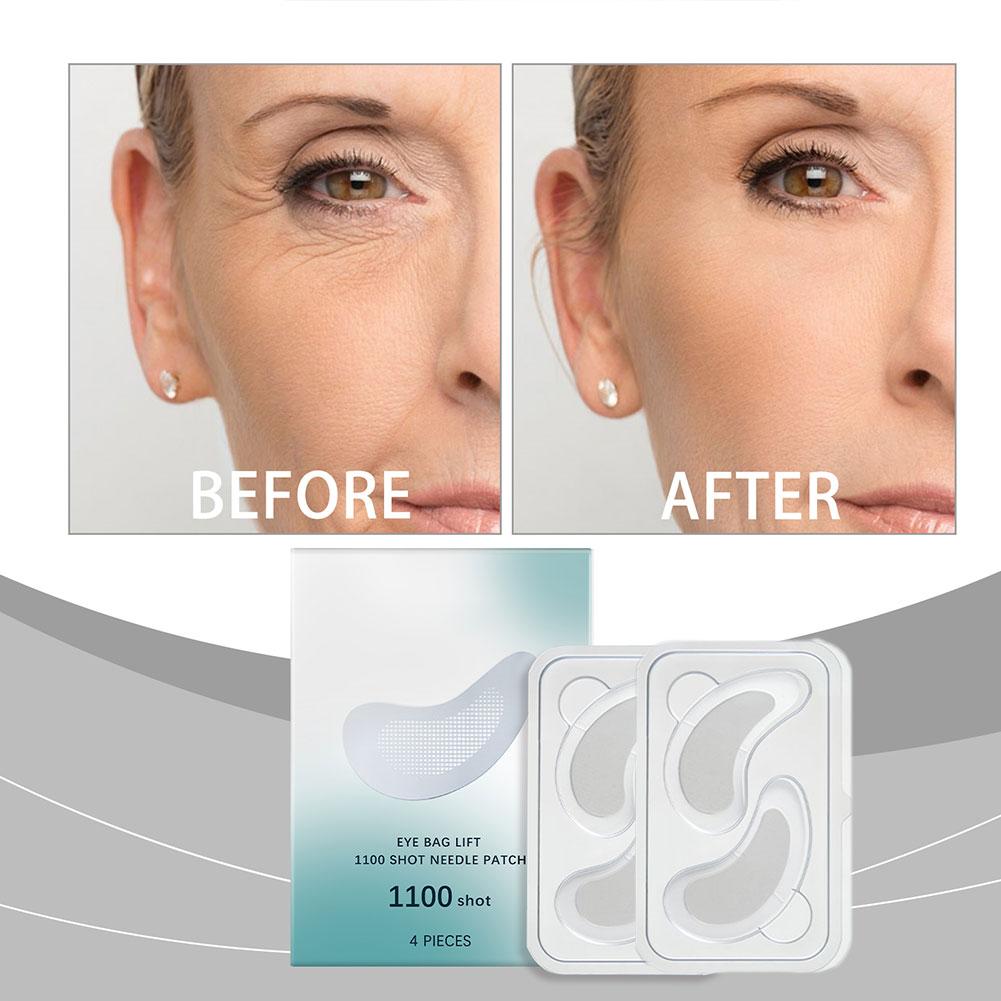 Hyaluronic Acid Microneedle Ey - Microneedle Patch Eye 评论和价格